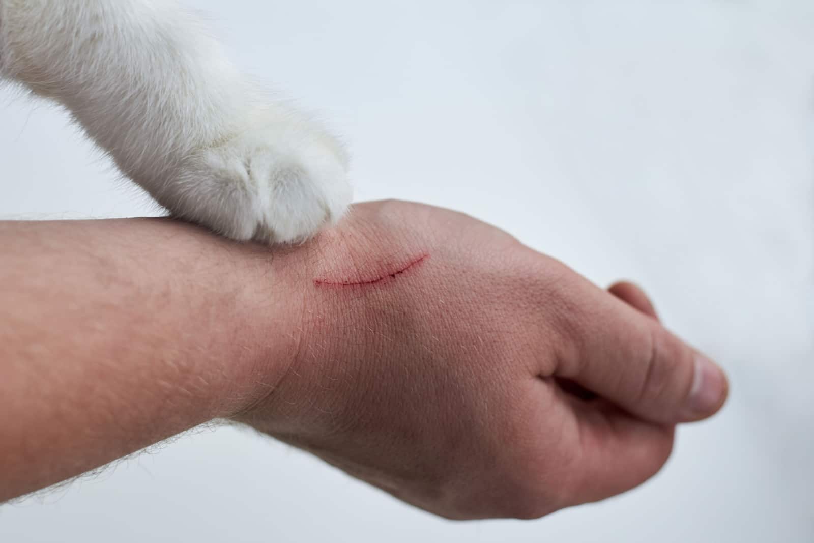 scratch on man's hand made by a cat